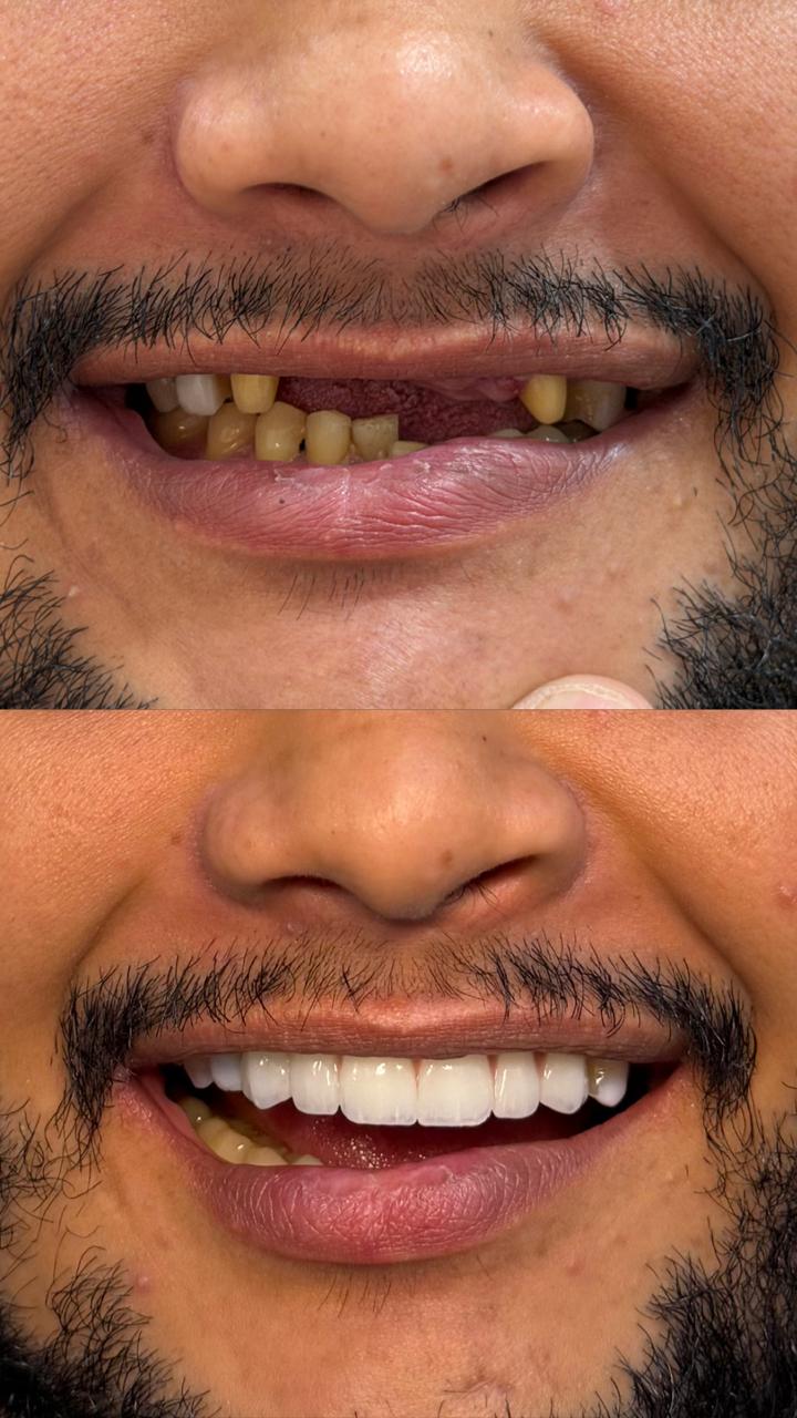 Antes e depois — caso real 1