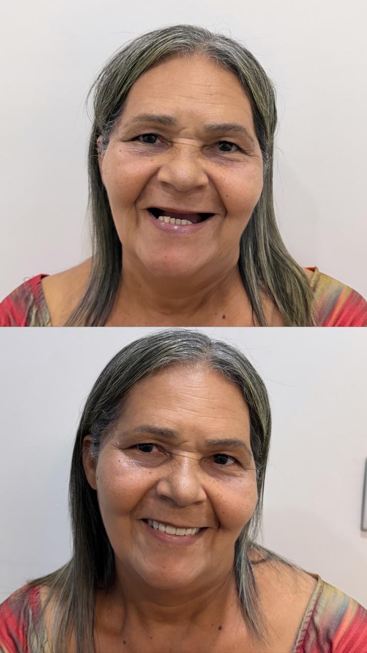 Antes e depois — caso real 3