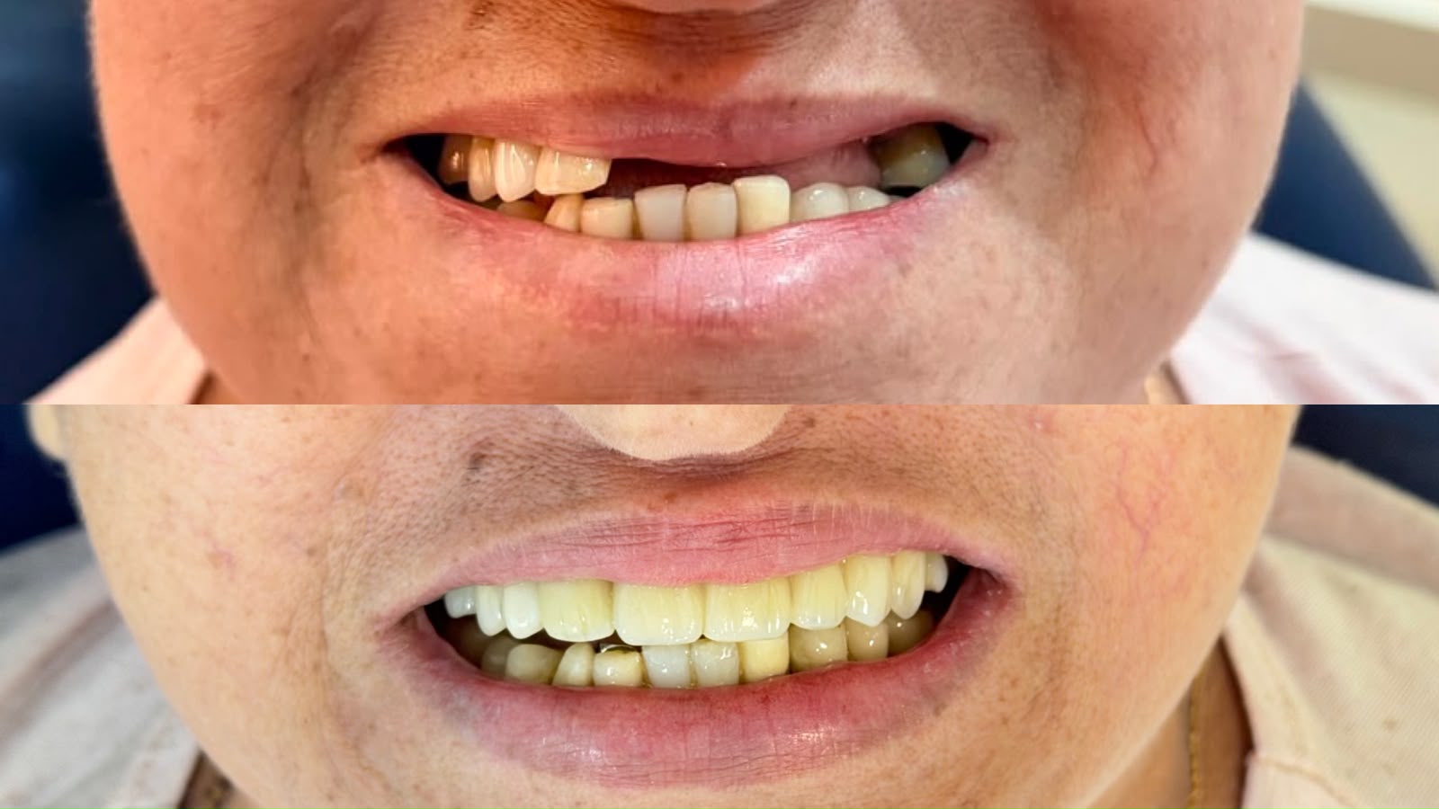 Antes e depois — caso real 4