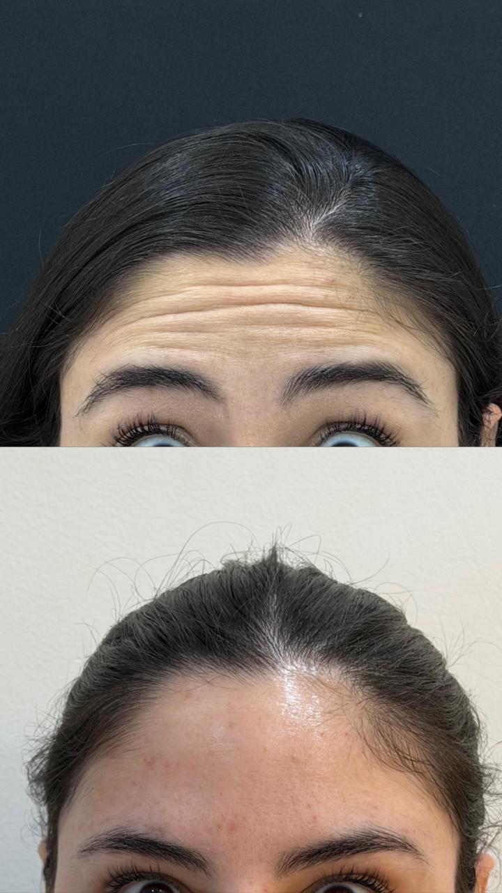 Antes e depois — caso real 5