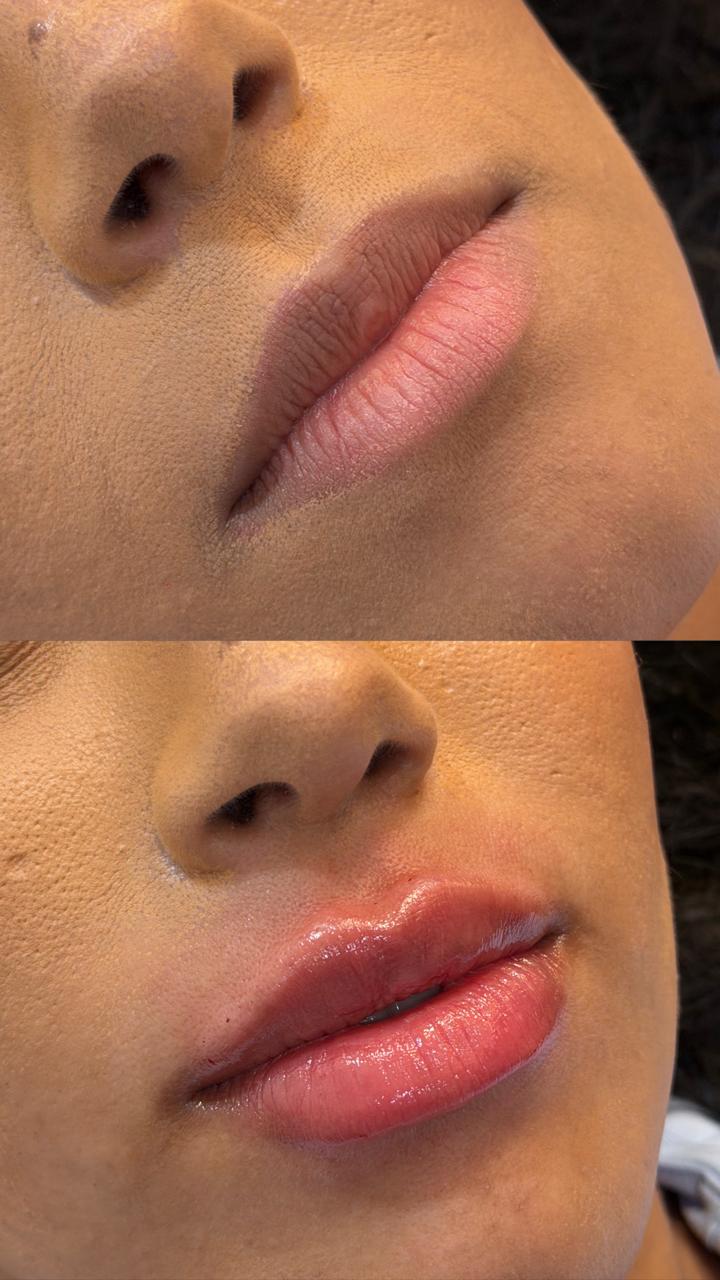 Antes e depois — caso real 7